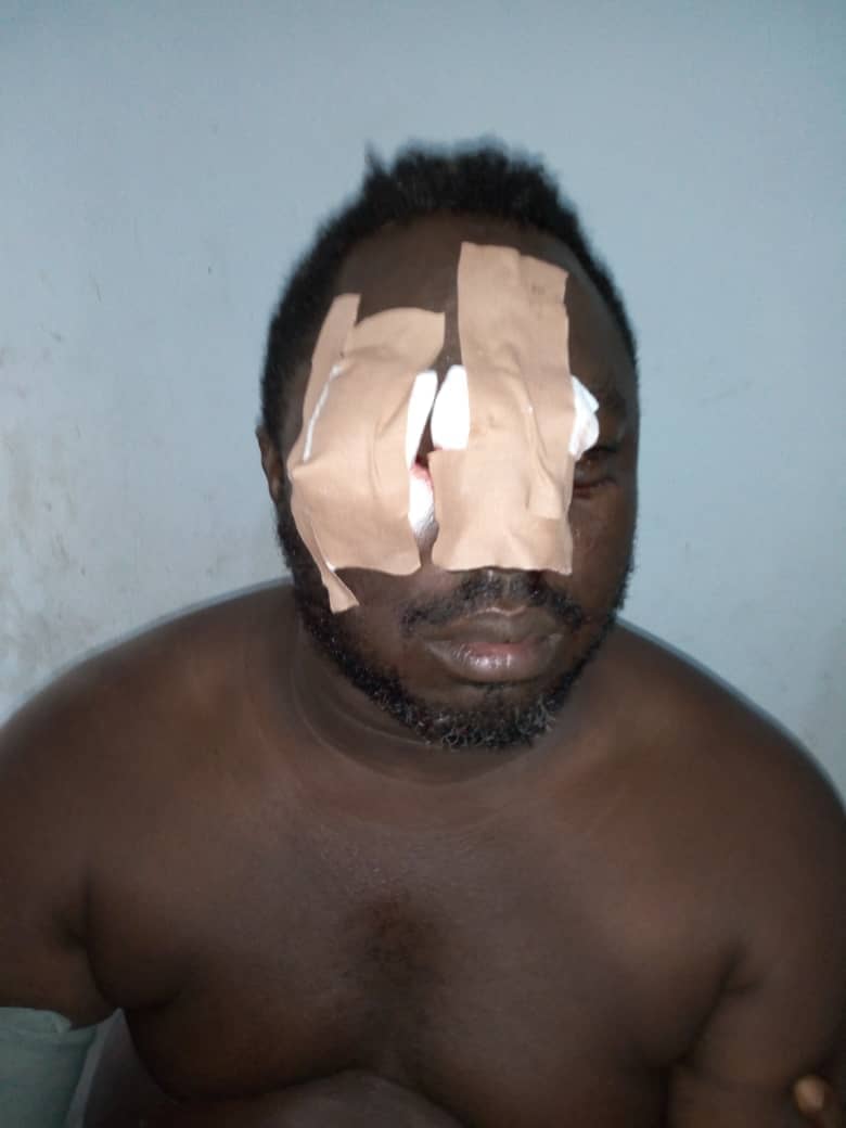 Ugbuwangue,Ogunu Clash: Ex-Warri South Supervisor,Willobi brutally injured