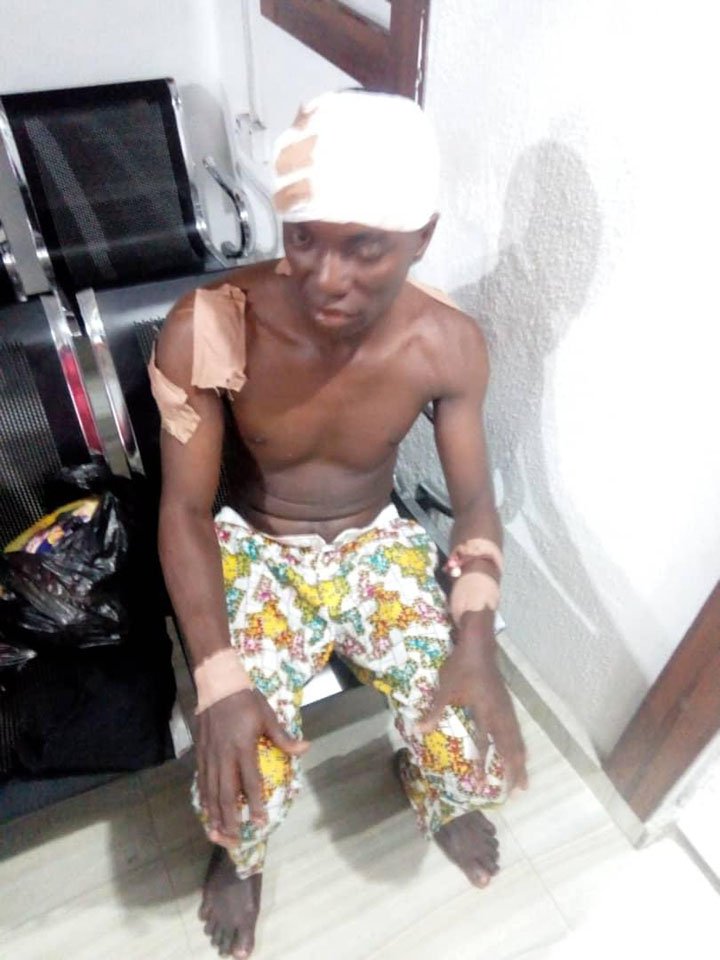 Attack on Buhari's supporter: No report was made to us-Police