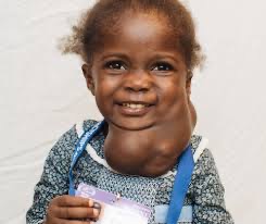 Mother’s relief as daughter given life-saving surgery by charity Mercy Ships