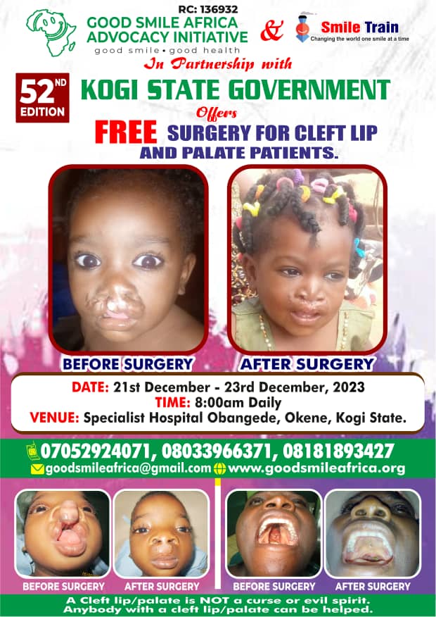 Cleft Lip, Palate Diseases: NGO Organises Free Surgery, Calls for Turn Out of Patients