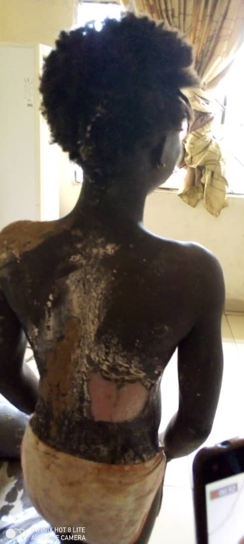 Kogi Government arrests Woman who poured hot water on her 14-year old sister